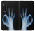S3239 X-Ray Hand Sign OK Case For Sony Xperia 1 V S3239 X-Ray Hand Sign OK Case For Sony Xperia 1 V