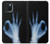 S3239 X-Ray Hand Sign OK Case For iPhone 15