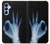 S3239 X-Ray Hand Sign OK Case For Samsung Galaxy A15 5G