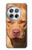 S2903 American Pitbull Dog Case For OnePlus 12