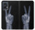 S3101 X-ray Peace Sign Fingers Case For Motorola Edge 50 Fusion