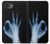 S3239 X-Ray Hand Sign OK Case For iPhone 16e, 17e