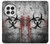 S2440 Biohazards Biological Hazard Case For OnePlus 13