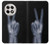 S3101 X-ray Peace Sign Fingers Case For OnePlus 13R