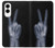 S3101 X-ray Peace Sign Fingers Case For Samsung Galaxy S25 Edge