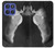 S1593 Ballet Pointe Shoe Case For Motorola Moto G Stylus 5G (2025,2026), Edge 60 Stylus