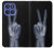 S3101 X-ray Peace Sign Fingers Case For Motorola Moto G Stylus 5G (2025,2026), Edge 60 Stylus