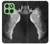 S1593 Ballet Pointe Shoe Case For Motorola Edge 60