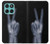 S3101 X-ray Peace Sign Fingers Case For Motorola Edge 60 Fusion