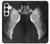 S1593 Ballet Pointe Shoe Case For Samsung Galaxy S25 FE, S26 FE