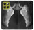S1593 Ballet Pointe Shoe Case For Motorola Moto G86