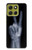 S3101 X-ray Peace Sign Fingers Case For Motorola Moto G86