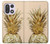 S3490 Gold Pineapple Case For OnePlus 15