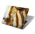 S4026 Women Crying Golden Tear Hard Case For MacBook Pro 15″ - A1707, A1990