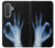 S3239 X-Ray Hand Sign OK Case For Samsung Galaxy A37