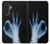 S3239 X-Ray Hand Sign OK Case For Samsung Galaxy A27