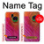 S3201 Pink Peacock Feather Case For Samsung Galaxy J7 (2018), J7 Aero, J7 Top, J7 Aura, J7 Crown, J7 Refine, J7 Eon, J7 V 2nd Gen, J7 Star