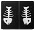 S2509 Fishbone Case For iPhone X, iPhone XS