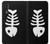 S2509 Fishbone Case For Samsung Galaxy A70