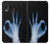 S3239 X-Ray Hand Sign OK Case For Samsung Galaxy A20, Galaxy A30