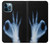 S3239 X-Ray Hand Sign OK Case For iPhone 12 Pro Max
