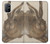 S3781 Albrecht Durer Young Hare Case For OnePlus 8T