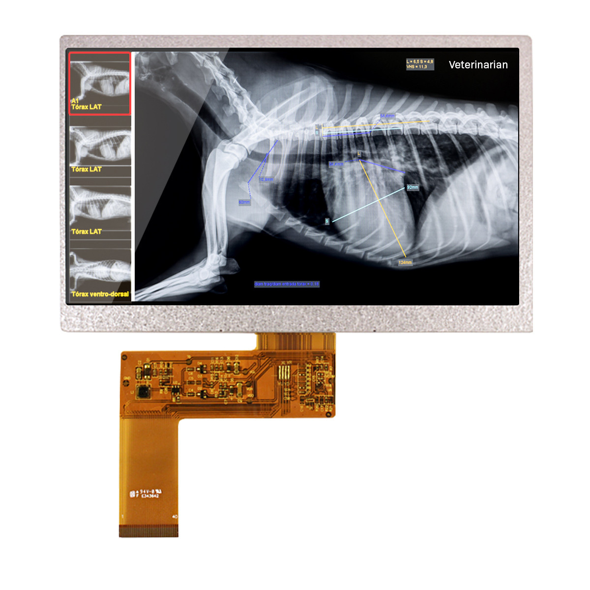 7 inch Premium MVA 800x480 Resolution TFT LCD