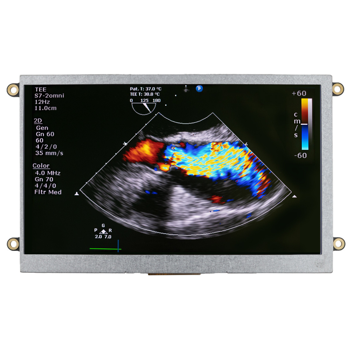 7 inch IPS 800x480 Resolution HDMI LCD Module