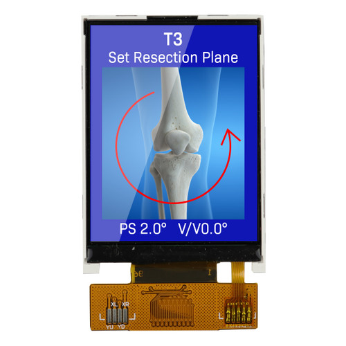 Front view of a 240x320 pixel TFT LCD showing a medical scan image of a bone on a blue background.