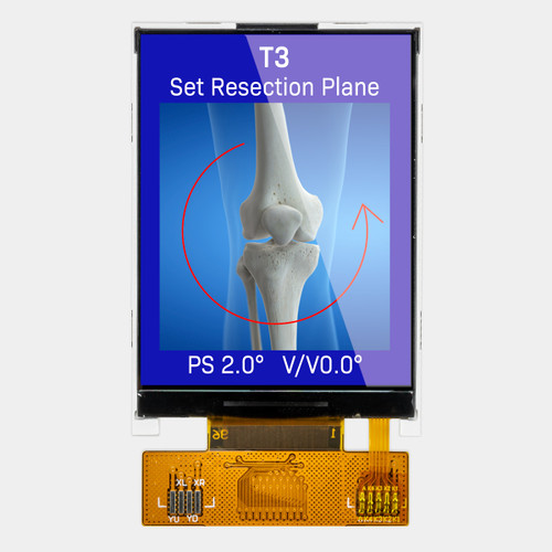 Front view of a 240x320 pixel TFT LCD showing a medical scan image of a bone on a blue background.
