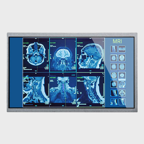 Front view of a 1024x600 pixel IPS TFT LCD showing images from an MRI scan.