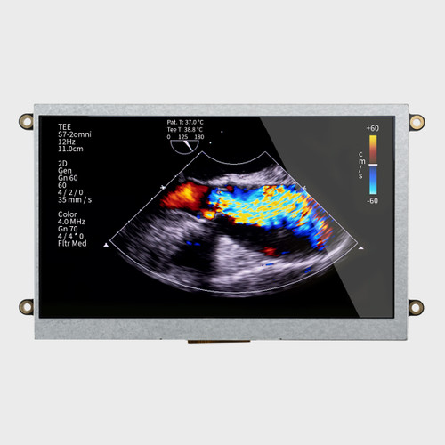 Front view of a bright 800x480 IPS TFT LCD module with mounting holes showing a full color ultrasound image.