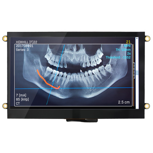 Front view of a bright 800x480 pixel IPS TFT LCD showing a dental X-ray.