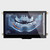 Front view of a bright 800x480 IPS TFT LCD module with capacitive touchscreen showing a dental X-ray on the screen.