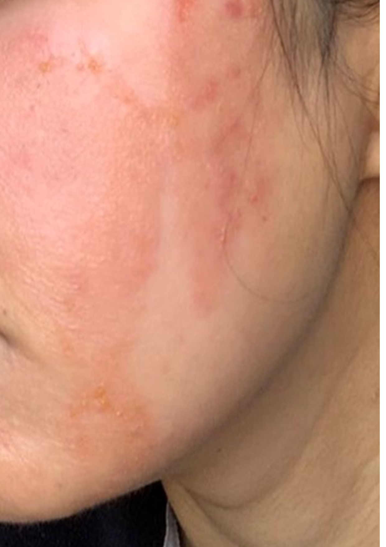 Retinol Why you should rethink about using it Essentially Yours