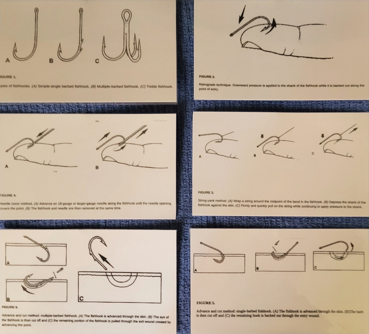 Set of 6 4x6 Fish Hook Removal Cards