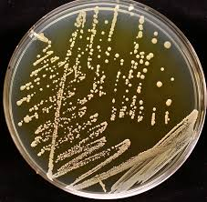 YSG-Agar Plate