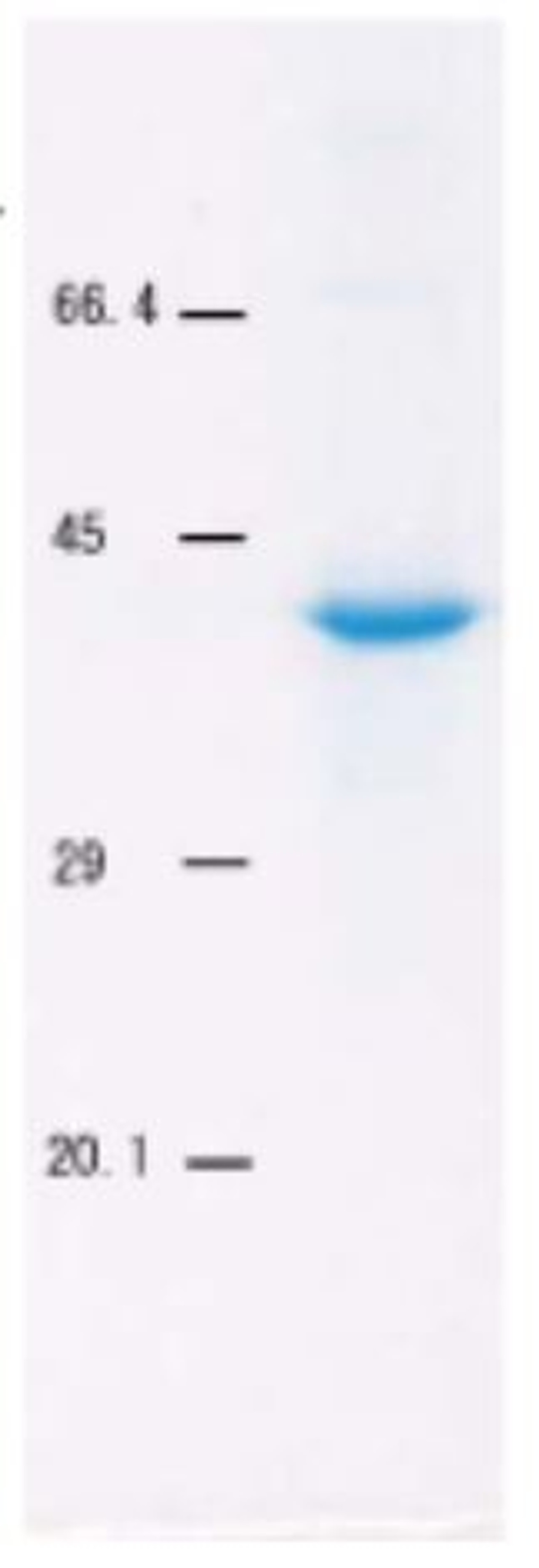 Hyaluronan Binding Protein [HABP] (Biotin Conj.) [Catalog No