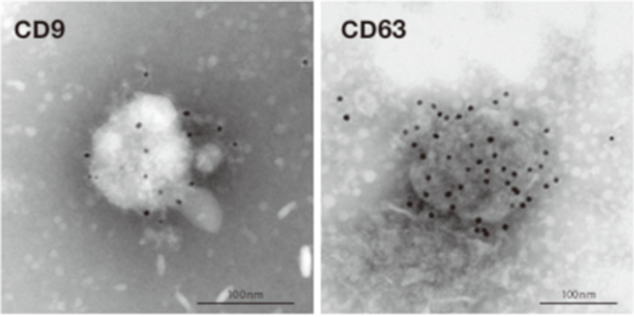 ACIDMAN CD16枚セット ACIDMAN CD16枚セット ACIDMAN CD16枚セット ACIDMAN CD16枚