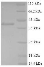 what is ipamorelin peptide used for what is cjc 1295 ipamorelin What Is CJC 1295 Ipamorelin? Discover its wellness benefits what is ipamorelin peptide used for what is cjc 1295 ipamorelin What Is CJC 1295 Ipamorelin? Discover its wellness benefits