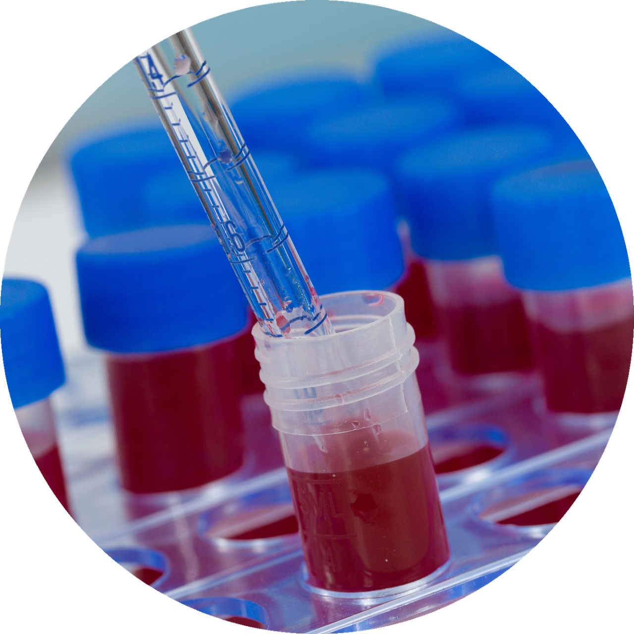 Polymorphprep™ [Catalog No.: AXS-1114683]