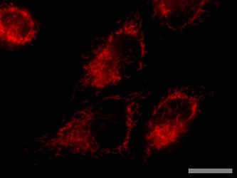 pMitophagy Keima-Red mPark2 (Kan)