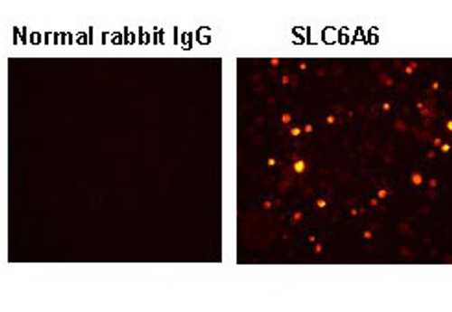 Anti-SLC6A6 (TAUT) (Human) pAb