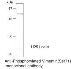 Anti-Phosphorylated Vimentin (Ser71) mAb (Clone: TM71)