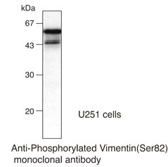 Anti-Phosphorylated Vimentin (Ser82) (Clone: MO82)