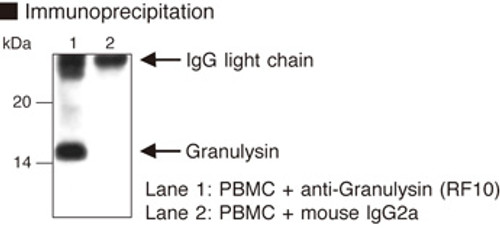 Anti-Granulysin (Human) mAb (Clone: RF10)