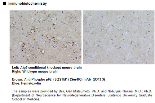 Anti-Phospho-p62 (SQSTM1) (Ser403) mAb (Clone: 4F6)