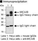 Anti-MICA/B (Human) mAb (Clone: BAMO3)
