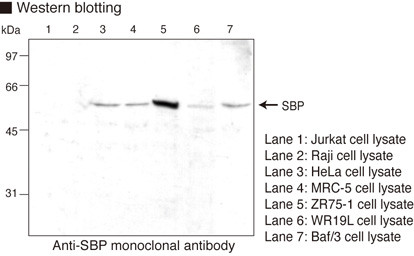 Anti-Selenium Binding Protein (Human) mAb (Clone: 4D4)