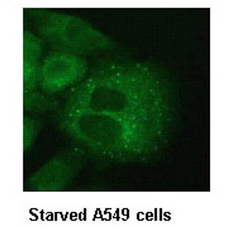 Anti-Atg12 (Human) mAb (Clone: 6E5)